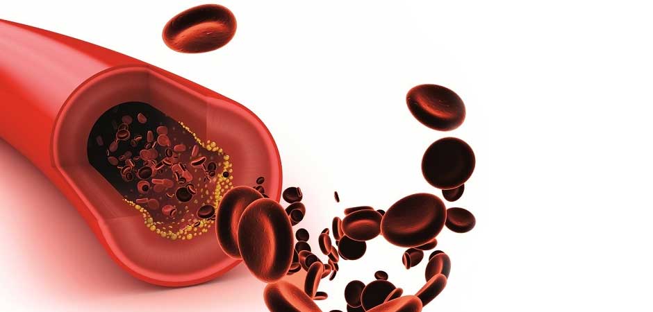 All About Cholesterol